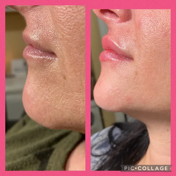 The SKN NP Picture 7