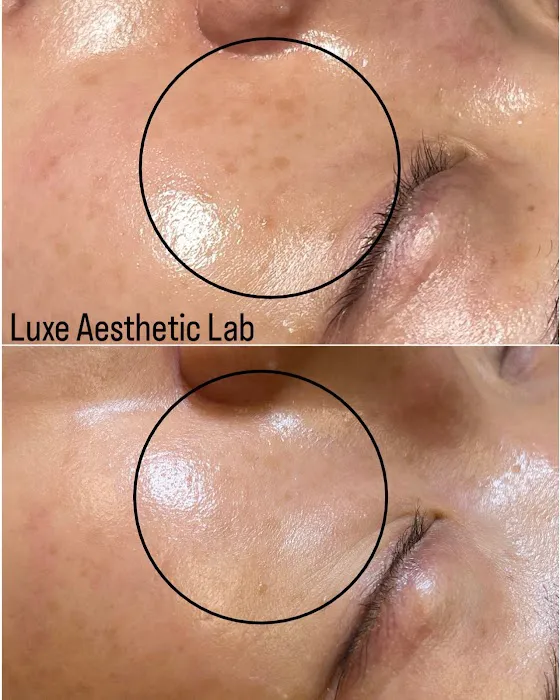LuxeAestheticLab Picture 6