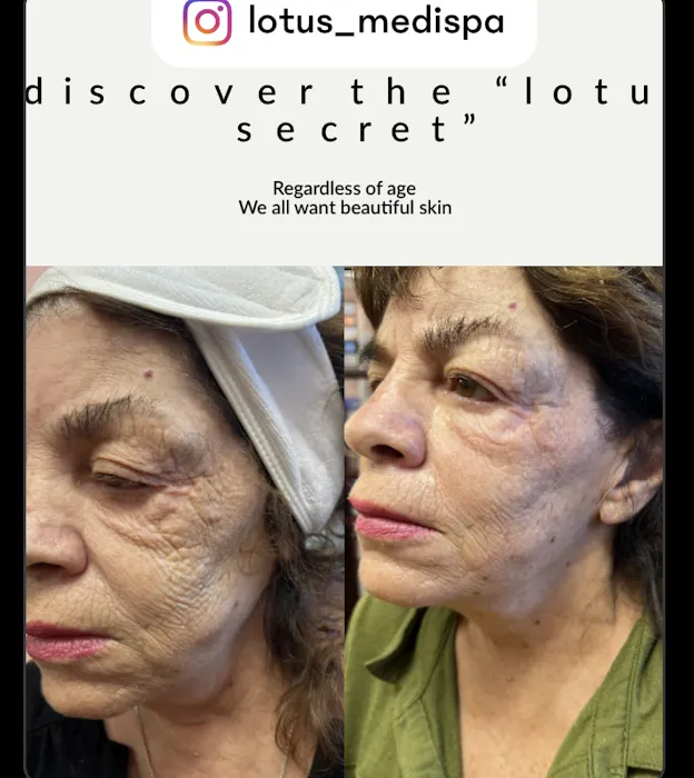 Lotus Skin Care Center Picture 3