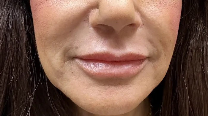 Lotus Skin Care Center Picture 10