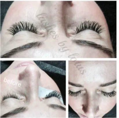 Lotus Skin Care Center Picture 8