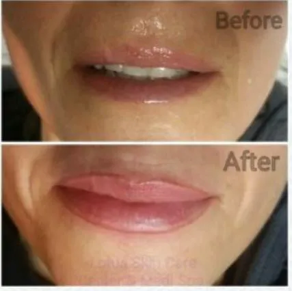 Lotus Skin Care Center Picture 9