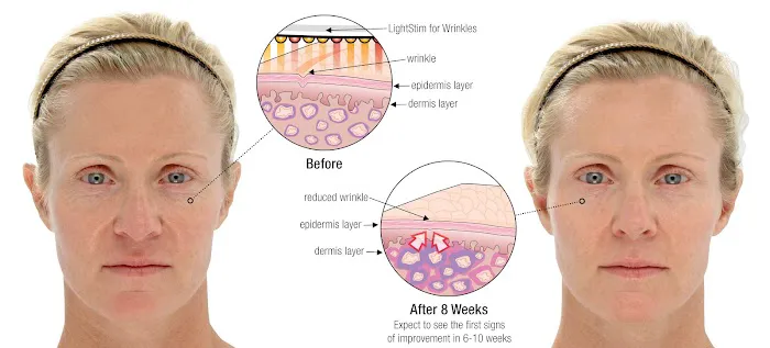 Long Island Skin Care @ erika cole salon and spa Picture 10