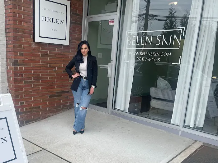 Belen Skin Picture 6