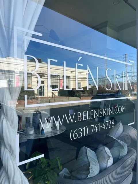 Belen Skin Picture 10