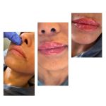 Flawless Skincare and Aesthetics