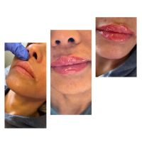 Flawless Skincare and Aesthetics ico