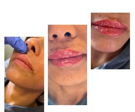 Flawless Skincare and Aesthetics