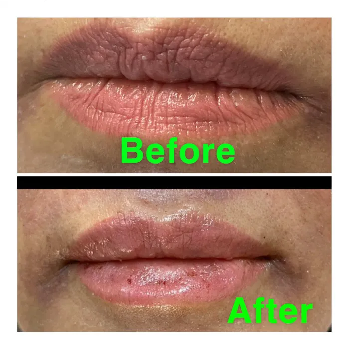 Flawless Skincare and Aesthetics Picture 2