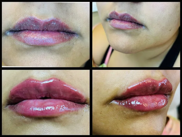 Flawless Skincare and Aesthetics Picture 3