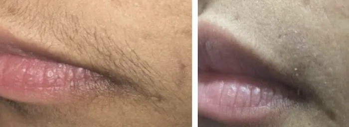 Flawless Skincare and Aesthetics Picture 7