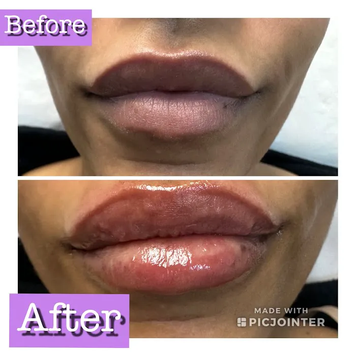 Flawless Skincare and Aesthetics Picture 5