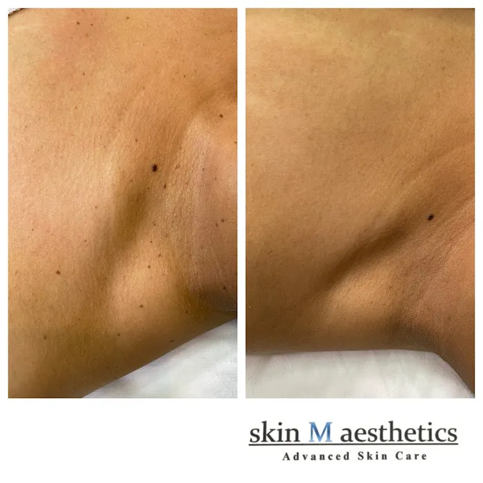 skin M aesthetics Picture 4