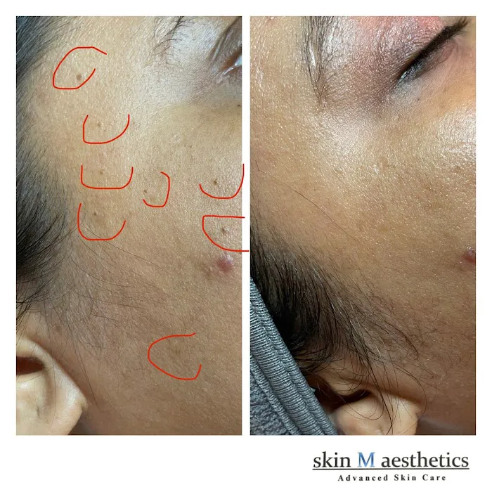 skin M aesthetics Picture 6