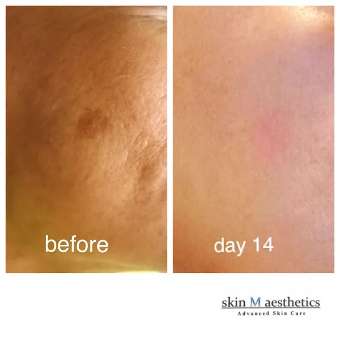 skin M aesthetics Picture 5