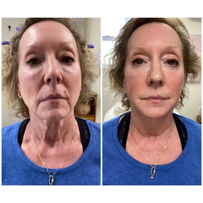 Eden Luxe Picture 10