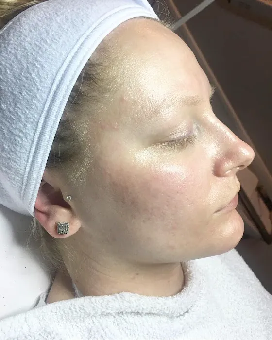 Pure Grace Esthetics, LLC Picture 6