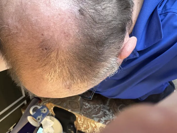 Semler Dermatology Inc. Picture 4