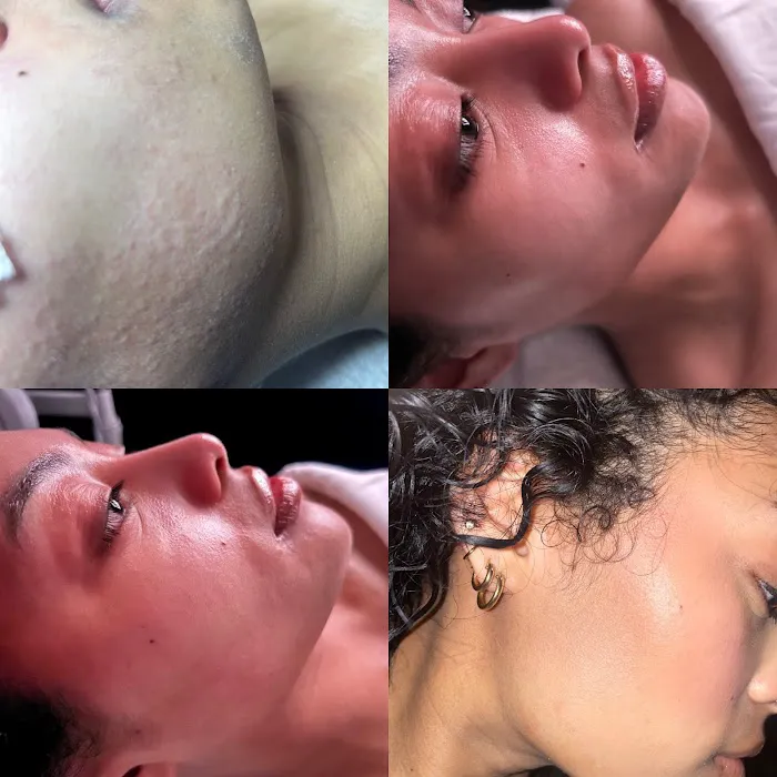 Glaer Skin Picture 5