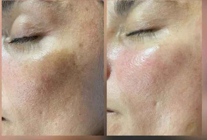 Suju Cosmic Skincare & Spa Picture 6