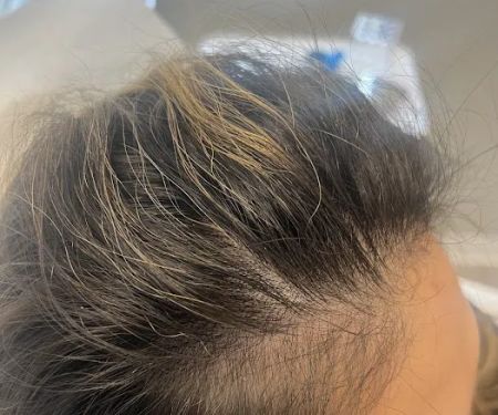 Neuskin Aesthetic and Wellness Clinic