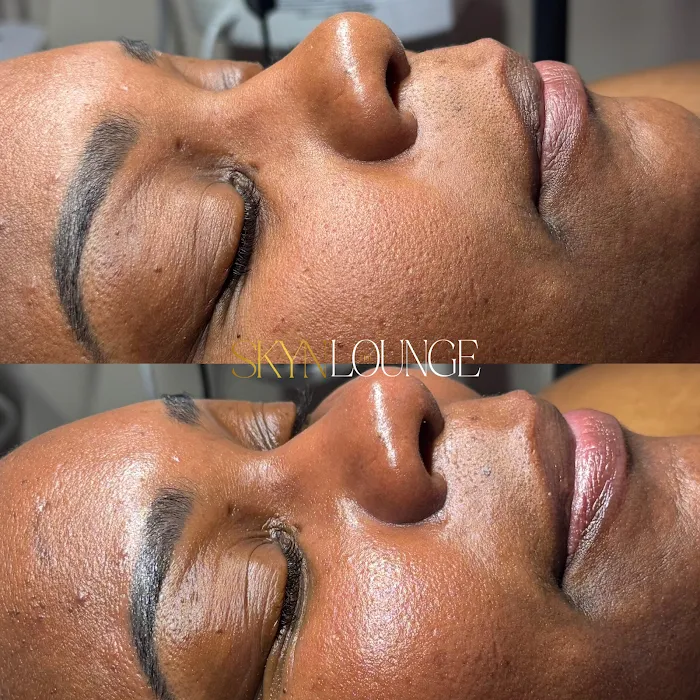 The Skyn Lounge- Dix Hills Brazilian Wax & Vajacials Picture 10
