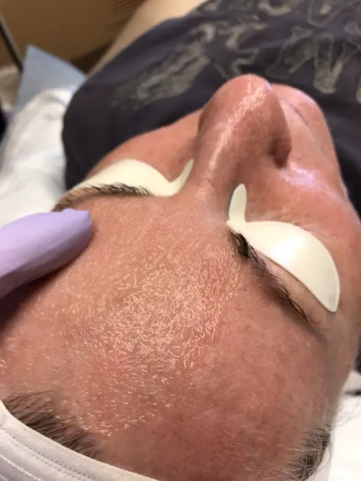 bare MedSpa & Wellness Picture 9