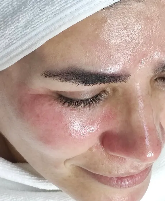 Aesthetic Skin Beauty Picture 6