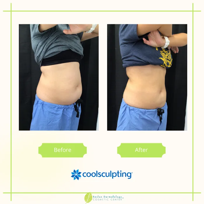 Reston Dermatology + Cosmetic Center Picture 6