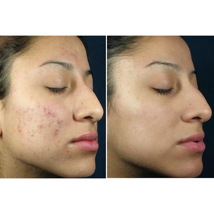 Reston Dermatology + Cosmetic Center Picture 7