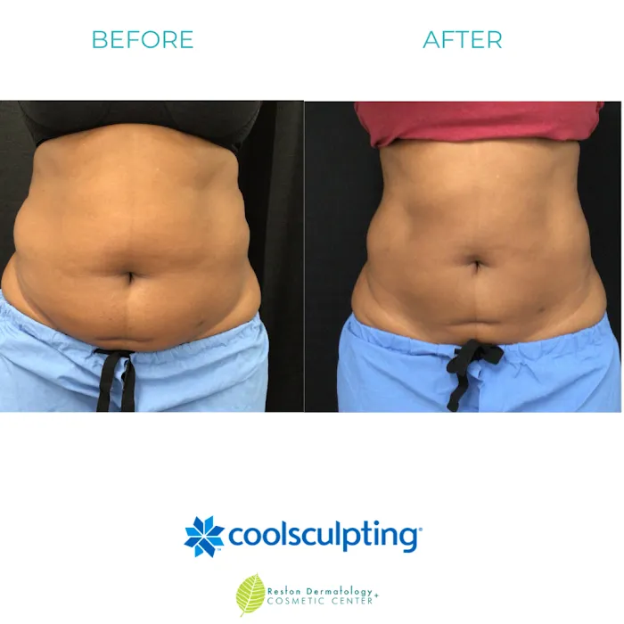 Reston Dermatology + Cosmetic Center Picture 8