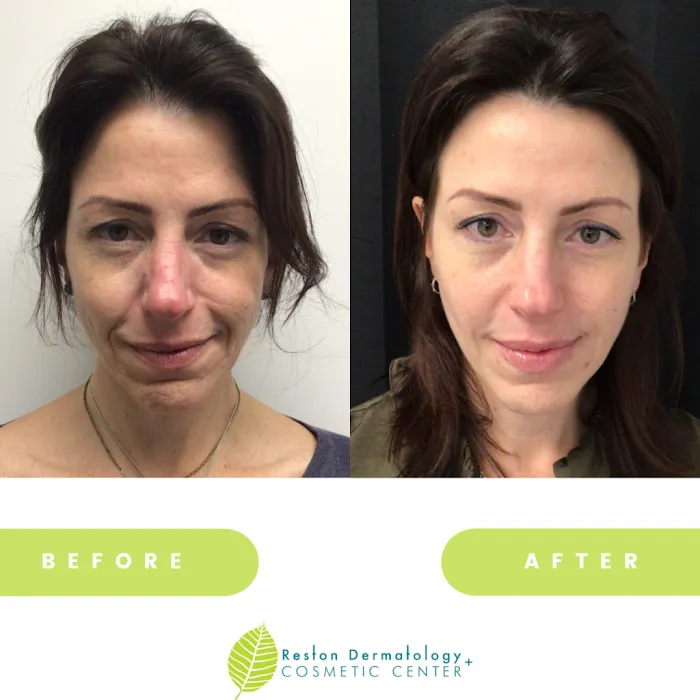 Reston Dermatology + Cosmetic Center Picture 10