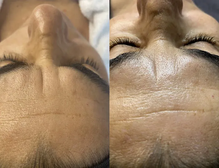 Ethereal Beauty Esthetics Picture 10