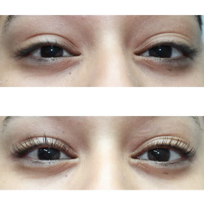 Ethereal Beauty Esthetics Picture 9