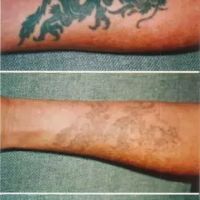 Messina Esthetic Medicine ico