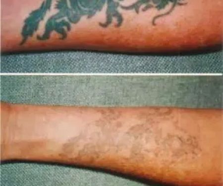 Messina Esthetic Medicine