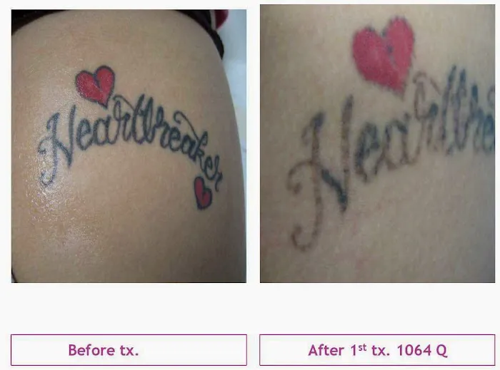 Messina Esthetic Medicine Picture 5