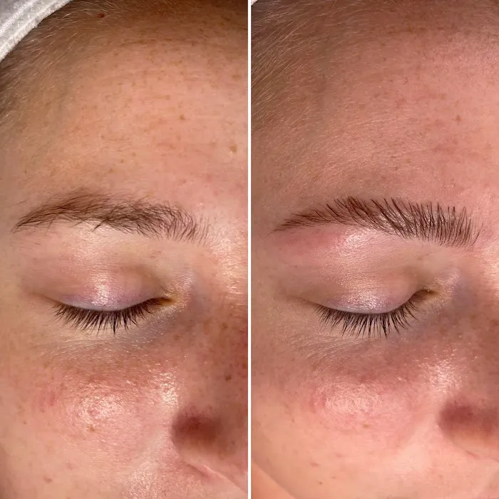 LG Aesthetics Skincare And Beauty Center Picture 8