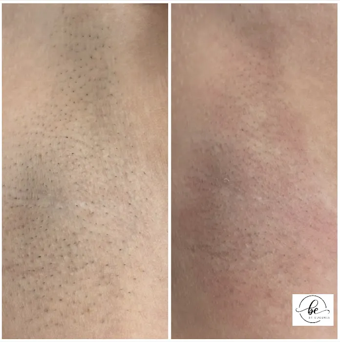 Bare Esthetics by Eugenia Picture 6