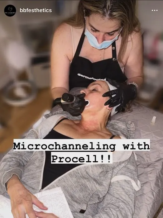 BBF ESTHETICS Picture 4