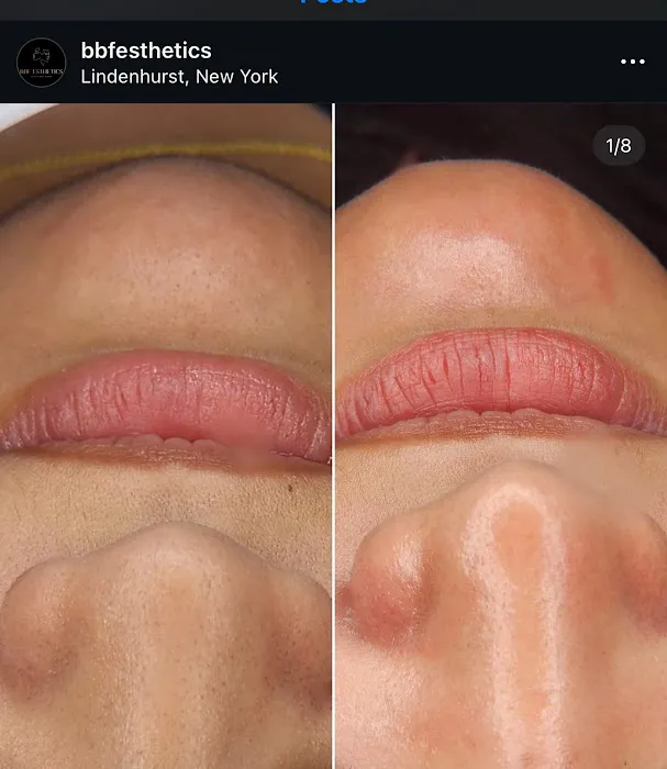 BBF ESTHETICS Picture 3