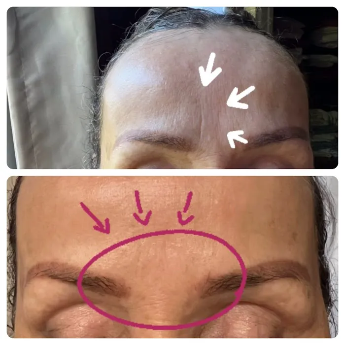 BBF ESTHETICS Picture 1