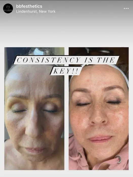 BBF ESTHETICS Picture 2