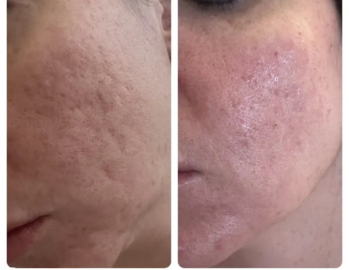 BBF ESTHETICS Picture 6