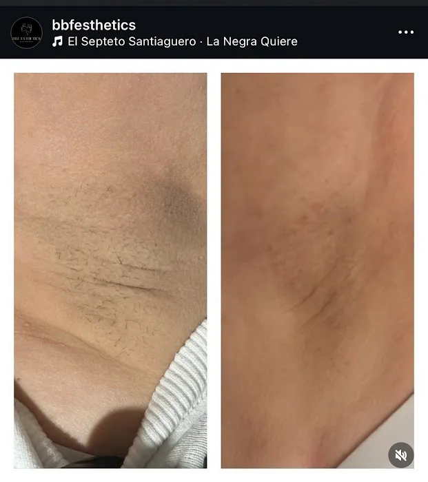 BBF ESTHETICS Picture 5