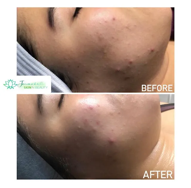 Jmarie Skin N Beauty Picture 8