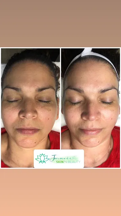 Jmarie Skin N Beauty Picture 9