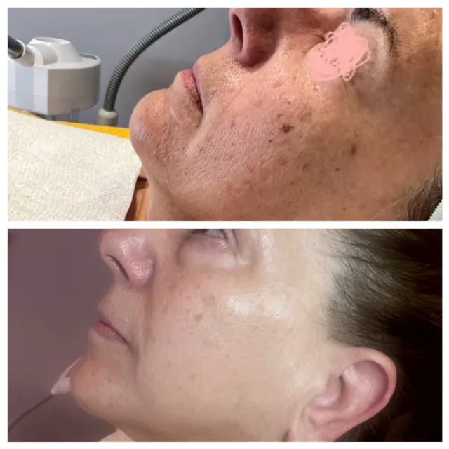 Rain Beauty Picture 4