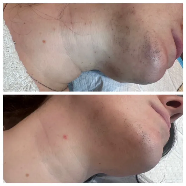 Rain Beauty Picture 6