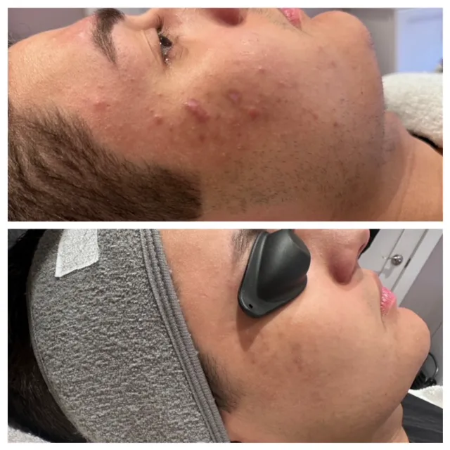 Rain Beauty Picture 7